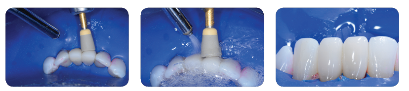 No.20 RS Polisher, Cup Shape 10ct