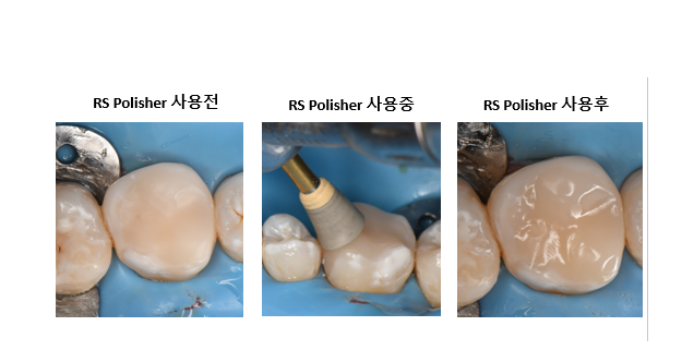 No.20 RS Polisher, Cup Shape 10ct