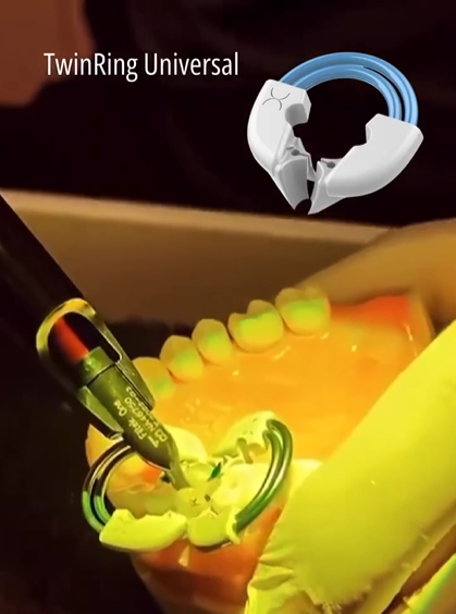 No.18 TwinRing Universal 2pk (트윈링 유니버설)