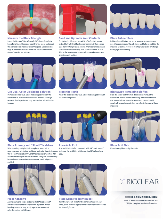 No.4  Black Triangle Procedure Kit (블랙트라이앵글  키트)