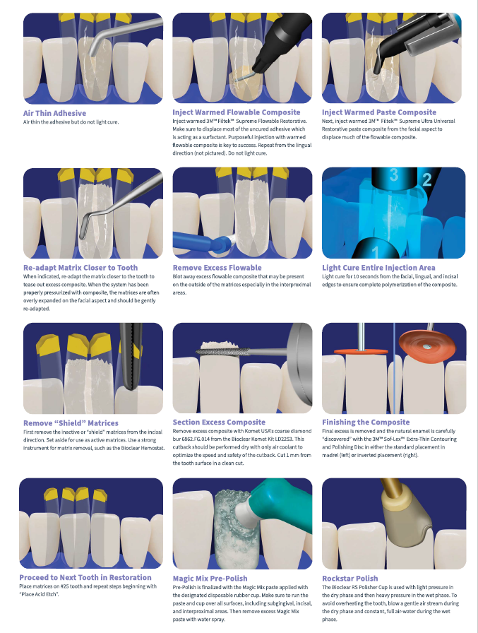 No.4  Black Triangle Procedure Kit (블랙트라이앵글  키트)