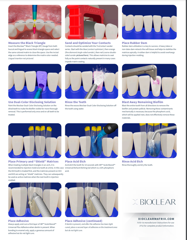 No.4  Black Triangle Procedure Kit (블랙트라이앵글  키트)